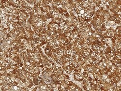 Invitrogen ALDH7A1 Monoclonal Antibody (11) 100 &mu;L; Unconjugated:Antibodies,