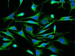 Invitrogen ALDH7A1 Recombinant Rabbit Monoclonal Antibody (101) 100 &mu;L;