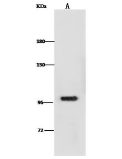 Invitrogen DOG-1 Recombinant Rabbit Monoclonal Antibody (006) 100 &mu;L | Buy Online | Invitrogen&trade; | Fisher Scientific