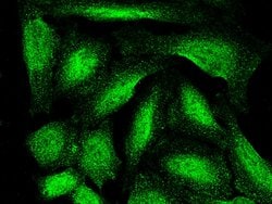 ARL2BP Recombinant Rabbit Monoclonal Antibody (001):Antibodies, Recombinant