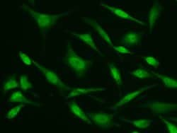 ASF1B Monoclonal Antibody (02):Antibodies, Monoclonal