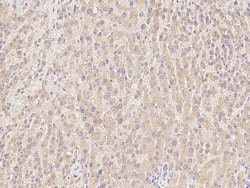 Invitrogen ASGR1 Monoclonal Antibody (02) 100 &mu;L; Unconjugated:Antibodies,