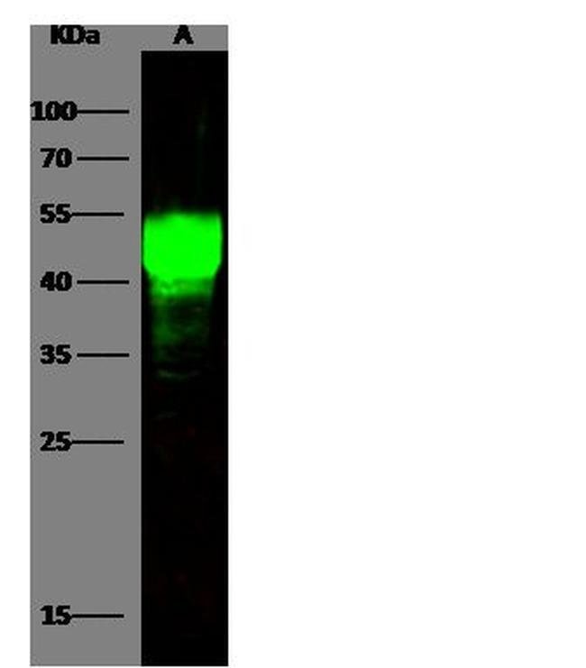 ASGR1 Recombinant Rabbit Monoclonal Antibody (21), Invitrogen 100 μL ...