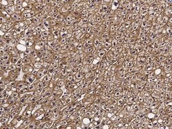 Invitrogen ASGR2 Recombinant Rabbit Monoclonal Antibody (002) 100 &mu;L | Buy Online | Invitrogen&trade; | Fisher Scientific