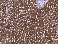 Invitrogen ASGR2 Recombinant Rabbit Monoclonal Antibody (002) 100 &mu;L | Buy Online | Invitrogen&trade; | Fisher Scientific