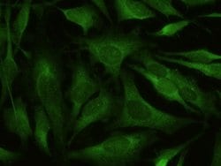 Invitrogen BACE1 Recombinant Rabbit Monoclonal Antibody (027) 100 &mu;L;