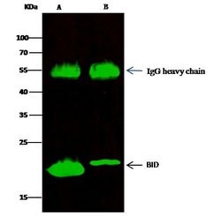 Invitrogen BID Recombinant Rabbit Monoclonal Antibody (002) 100 &mu;L | Buy Online | Invitrogen&trade; | Fisher Scientific