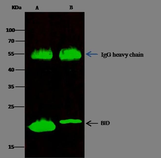 BID Recombinant Rabbit Monoclonal Antibody (2), Invitrogen 100 μL ...