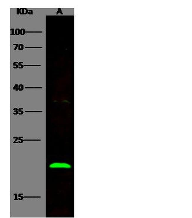 BID Recombinant Rabbit Monoclonal Antibody (002), Invitrogen 100 μL ...