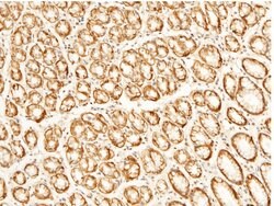 Invitrogen CD147 Recombinant Rabbit Monoclonal Antibody (125) 100 &mu;L;