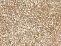 Invitrogen BTD Recombinant Rabbit Monoclonal Antibody (006) 100 &mu;L | Buy Online | Invitrogen&trade; | Fisher Scientific