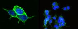 Invitrogen Carbonic Anhydrase XII Monoclonal Antibody (04) 100 &mu;L; Unconjugated:Antibodies,