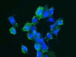 Invitrogen Carbonic Anhydrase XIV Recombinant Rabbit Monoclonal Antibody (515) 100 &mu;L | Buy Online | Invitrogen&trade; | Fisher Scientific
