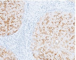 Invitrogen Carbonic Anhydrase XIV Recombinant Rabbit Monoclonal Antibody (515) 100 &mu;L | Buy Online | Invitrogen&trade; | Fisher Scientific