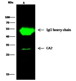 Invitrogen Carbonic Anhydrase II Recombinant Rabbit Monoclonal Antibody (001) 100 &mu;L | Buy Online | Invitrogen&trade; | Fisher Scientific