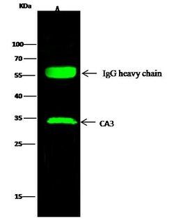 Invitrogen Carbonic Anhydrase III Recombinant Rabbit Monoclonal Antibody (006) 100 &mu;L | Buy Online | Invitrogen&trade; | Fisher Scientific