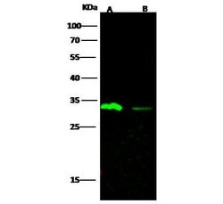 Invitrogen Carbonic Anhydrase III Recombinant Rabbit Monoclonal Antibody (006) 100 &mu;L | Buy Online | Invitrogen&trade; | Fisher Scientific