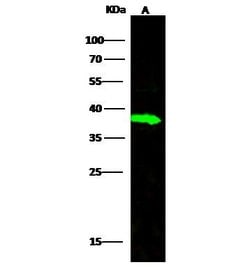 Invitrogen Carbonic Anhydrase VIII Recombinant Rabbit Monoclonal Antibody
