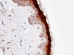 Invitrogen CALML5 Recombinant Rabbit Monoclonal Antibody (119) 100 &mu;L;
