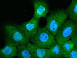 Invitrogen CALML5 Recombinant Rabbit Monoclonal Antibody (158) 100 &mu;L;