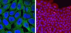 Invitrogen Caspase 14 Monoclonal Antibody (05) 100 &mu;L; Unconjugated:Antibodies,