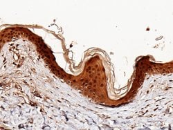 Invitrogen Caspase 14 Monoclonal Antibody (09) 100 &mu;L; Unconjugated:Antibodies,
