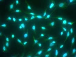 Invitrogen Caspase 14 Recombinant Rabbit Monoclonal Antibody (101) 100 &mu;L | Buy Online | Invitrogen&trade; | Fisher Scientific