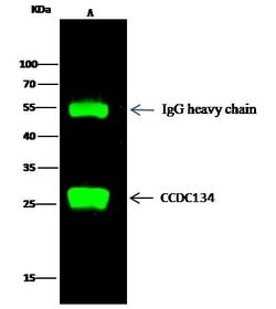 Invitrogen CCDC134 Recombinant Rabbit Monoclonal Antibody (026) 100 &mu;L;
