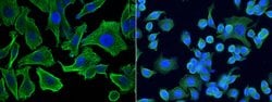 Invitrogen MCP-3 Monoclonal Antibody (18) 100 &mu;L; Unconjugated:Antibodies,