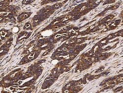 Invitrogen CD164 Monoclonal Antibody (05) 100 &mu;L; Unconjugated:Antibodies,