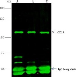 Invitrogen CD19 Recombinant Rabbit Monoclonal Antibody (303) 100 &mu;L;