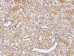 Invitrogen CD200 Recombinant Rabbit Monoclonal Antibody (333) 100 &mu;L;