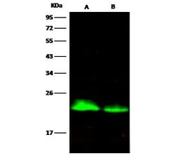 Invitrogen CD3d Recombinant Rabbit Monoclonal Antibody (138) 100 &mu;L;
