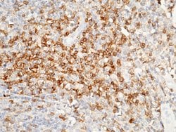 Invitrogen CD4 Recombinant Rabbit Monoclonal Antibody (113) 100 &mu;L;