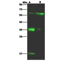 Invitrogen CD58 Recombinant Rabbit Monoclonal Antibody (085) 100 &mu;L;