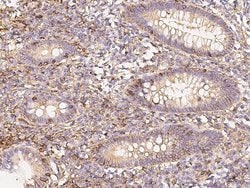 Invitrogen CD58 Recombinant Rabbit Monoclonal Antibody (126) 100 &mu;L;