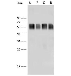 Invitrogen CD58 Recombinant Rabbit Monoclonal Antibody (185) 100 &mu;L;