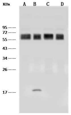 Invitrogen CD58 Recombinant Rabbit Monoclonal Antibody (186) 100 &mu;L;