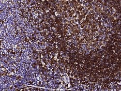 Invitrogen CD74 Monoclonal Antibody (01) 100 &mu;L; Unconjugated:Antibodies,