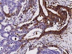 Invitrogen CD74 Monoclonal Antibody (01) 100 &mu;L; Unconjugated:Antibodies,