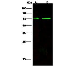 Invitrogen CD83 Recombinant Rabbit Monoclonal Antibody (104) 100 &mu;L;