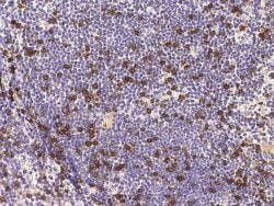 CD8 beta Recombinant Rabbit Monoclonal Antibody (039) 100 &mu;L | Buy Online | Thermo Scientific | Fisher Scientific
