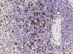 CD8 beta Recombinant Rabbit Monoclonal Antibody (039) 100 &mu;L | Buy Online | Thermo Scientific | Fisher Scientific