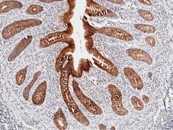 Invitrogen CDH17 Monoclonal Antibody (05) 100 &mu;L; Unconjugated:Antibodies,