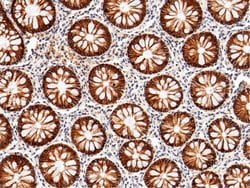 Invitrogen CDH17 Recombinant Rabbit Monoclonal Antibody (029) 100 &mu;L;