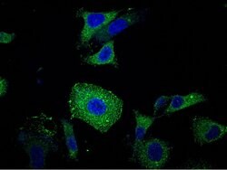 CEACAM6 Recombinant Rabbit Monoclonal Antibody (408), Invitrogen 100 &mu;L;