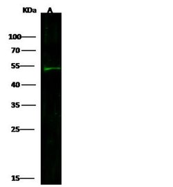 CEACAM6 Recombinant Rabbit Monoclonal Antibody (408), Invitrogen 100 &mu;L;