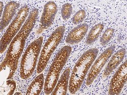 Invitrogen CES3 Recombinant Rabbit Monoclonal Antibody (033) 100 &mu;L | Buy Online | Invitrogen&trade; | Fisher Scientific