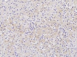 Invitrogen CES3 Recombinant Rabbit Monoclonal Antibody (033) 100 &mu;L | Buy Online | Invitrogen&trade; | Fisher Scientific