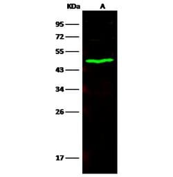 Invitrogen CES3 Recombinant Rabbit Monoclonal Antibody (372) 100 &mu;L;
